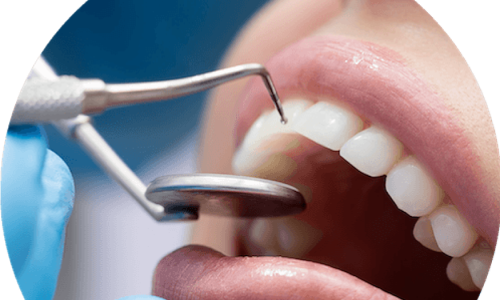 Esztétikai fogászat